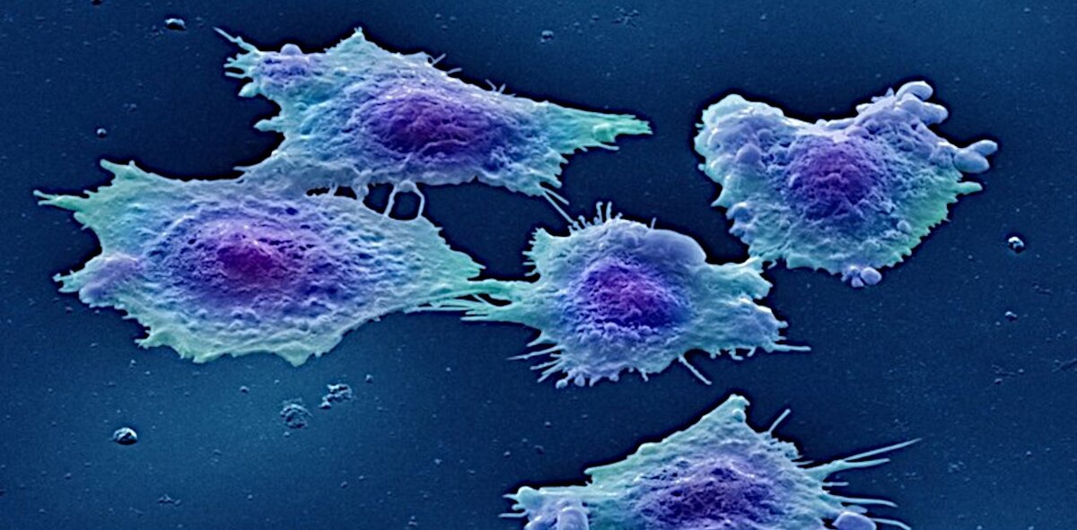 Культивируемые клетки колоректального рака человека 