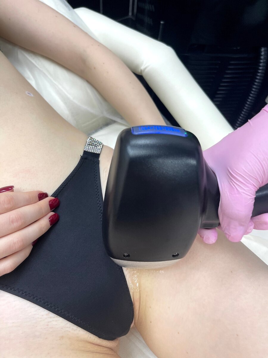 Желание иметь идеально гладкую кожу в интимных зонах – это мечта многих женщин. Ухаживать за такой чувствительной кожей бывает сложно. Выход-лазерная эпиляция!