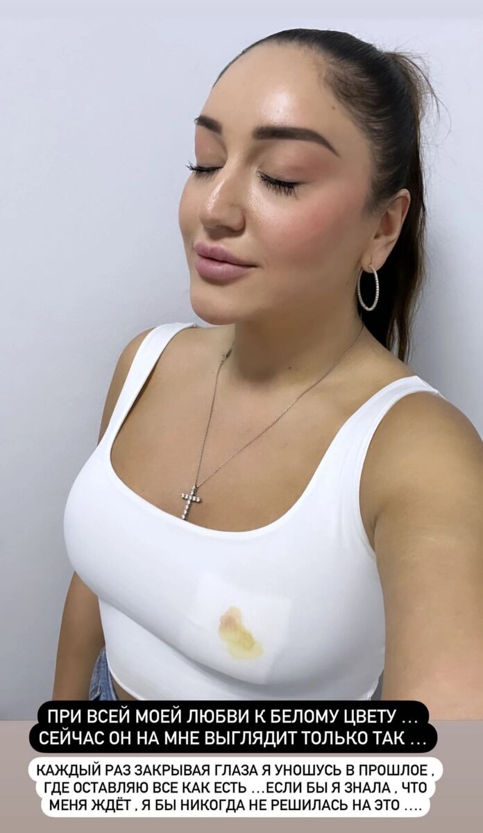 Красота требует жертв. Но явно не таких, как у героинь нашей сегодняшней подборки. Рассказываем о случаях со знаменитостями, когда улучшайзинг не принёс ничего хорошего.-5