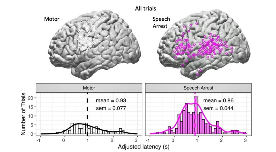   Heather Kabakoff et al. / Brain Communications, 2024