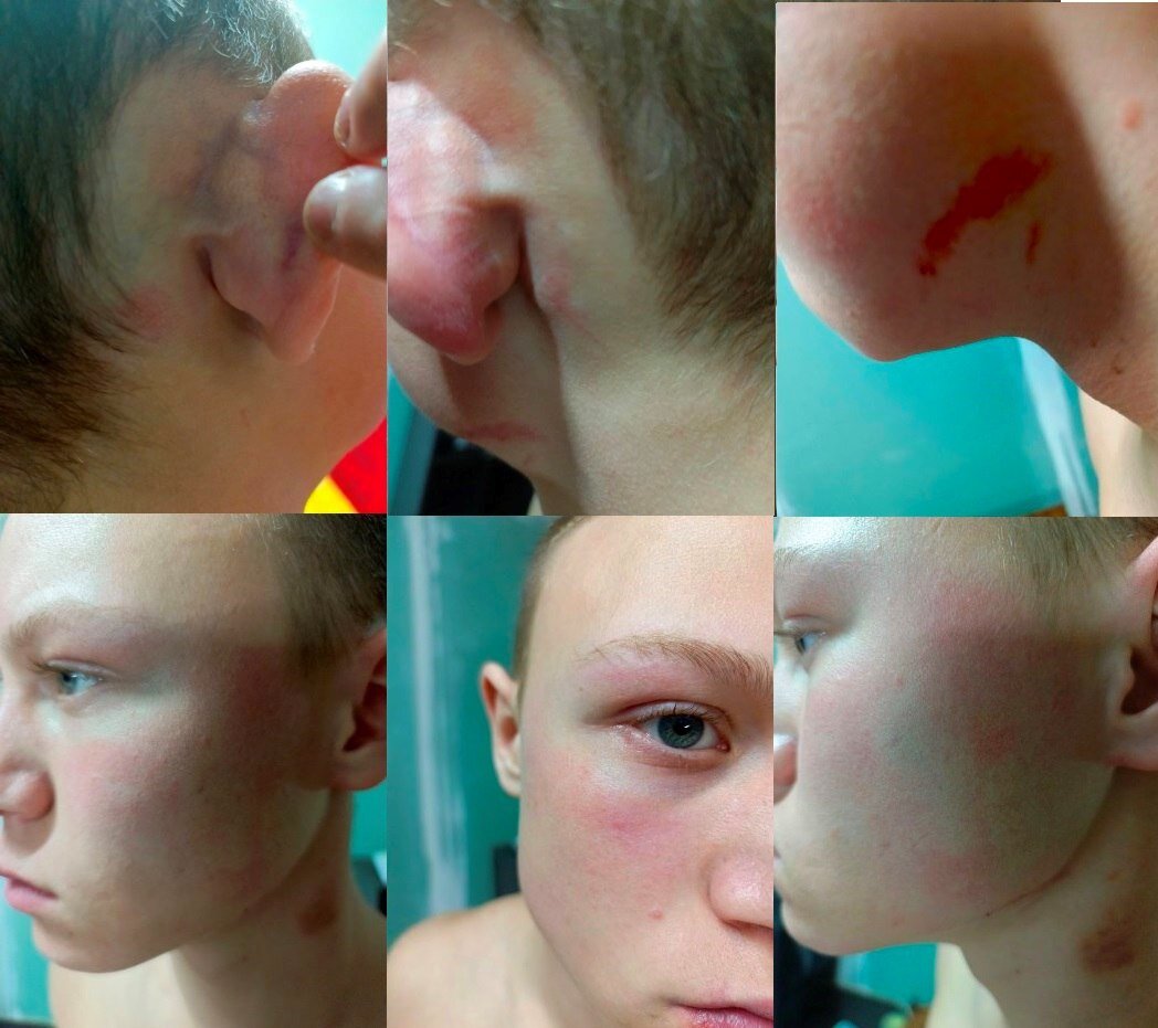 Подросток пострадал от рук взрослого мужчины. Фото: телеграм-канал "Русская Община".