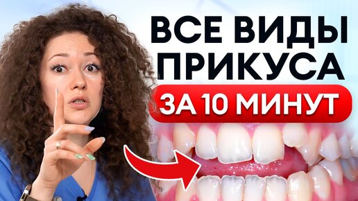 Чем ОПАСНЫ кривые зубы? / Какие виды неправильного ПРИКУСА существуют?