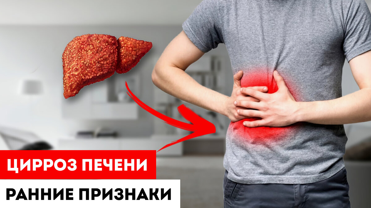 Цирроз Как выжить? Диагностика и лечение цирроза печени