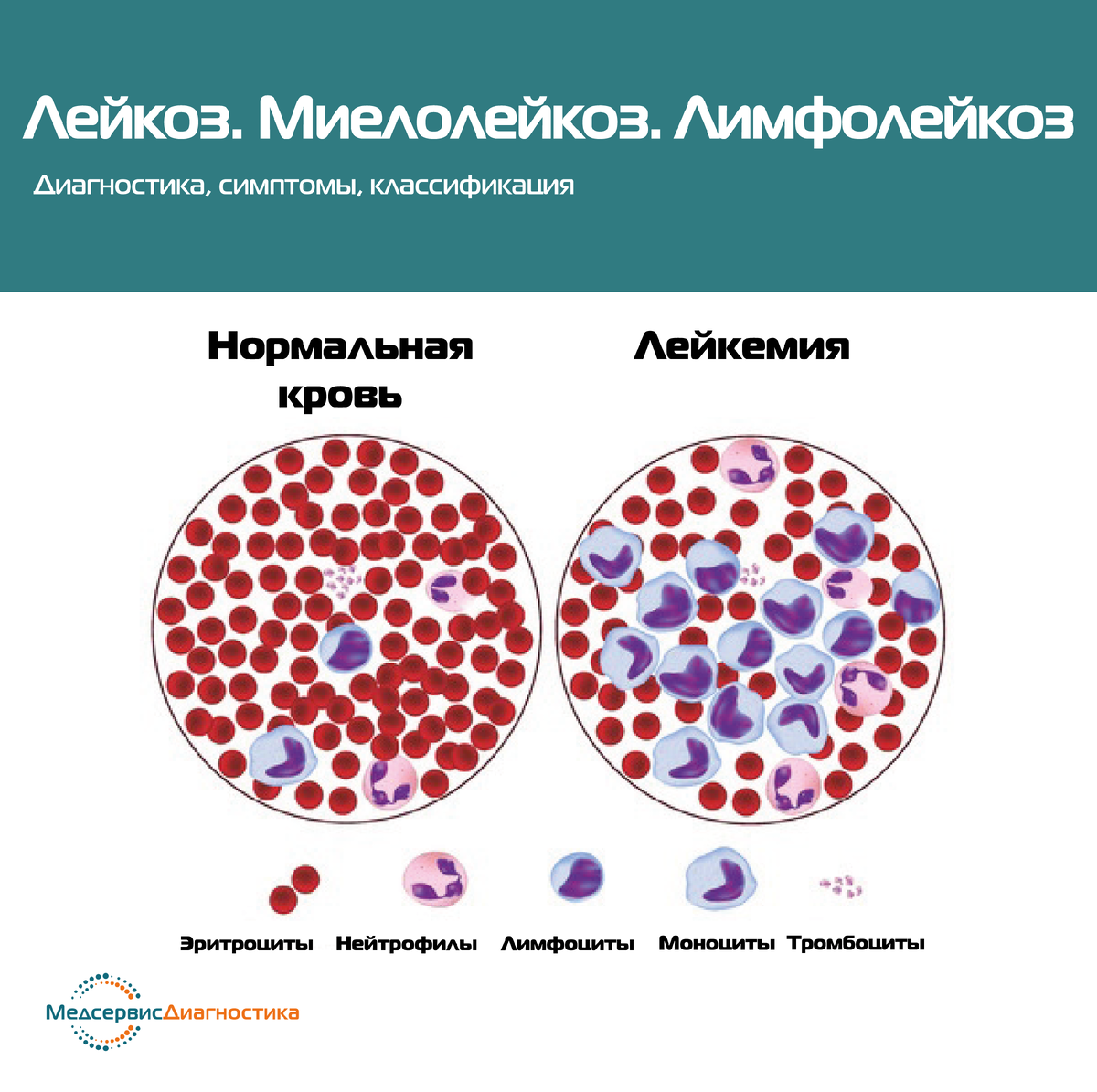 Нормальная кровь и лейкемия