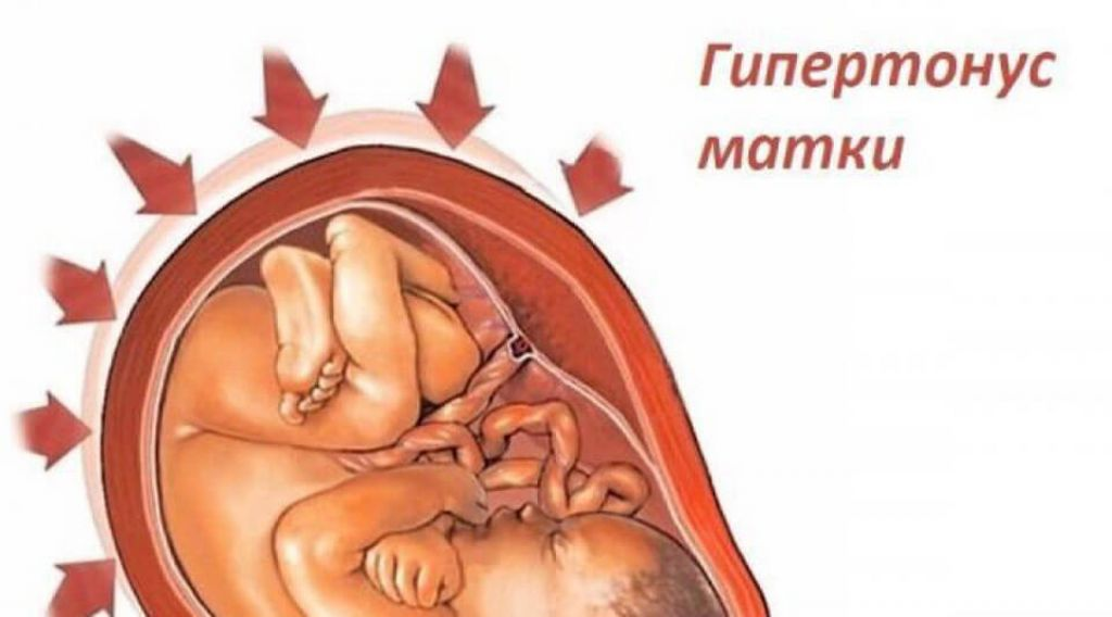 Что такое вагинизм и что делать, если вам больно во время секса - Афиша Daily