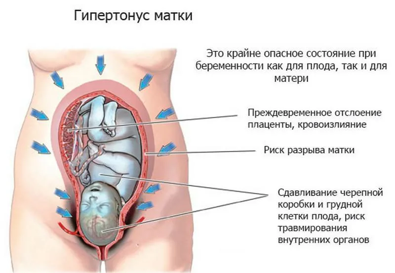 Тонус матки