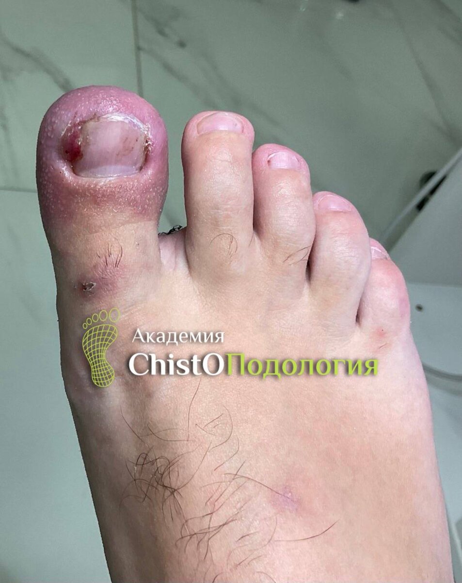 Молодой человек 17 лет. 