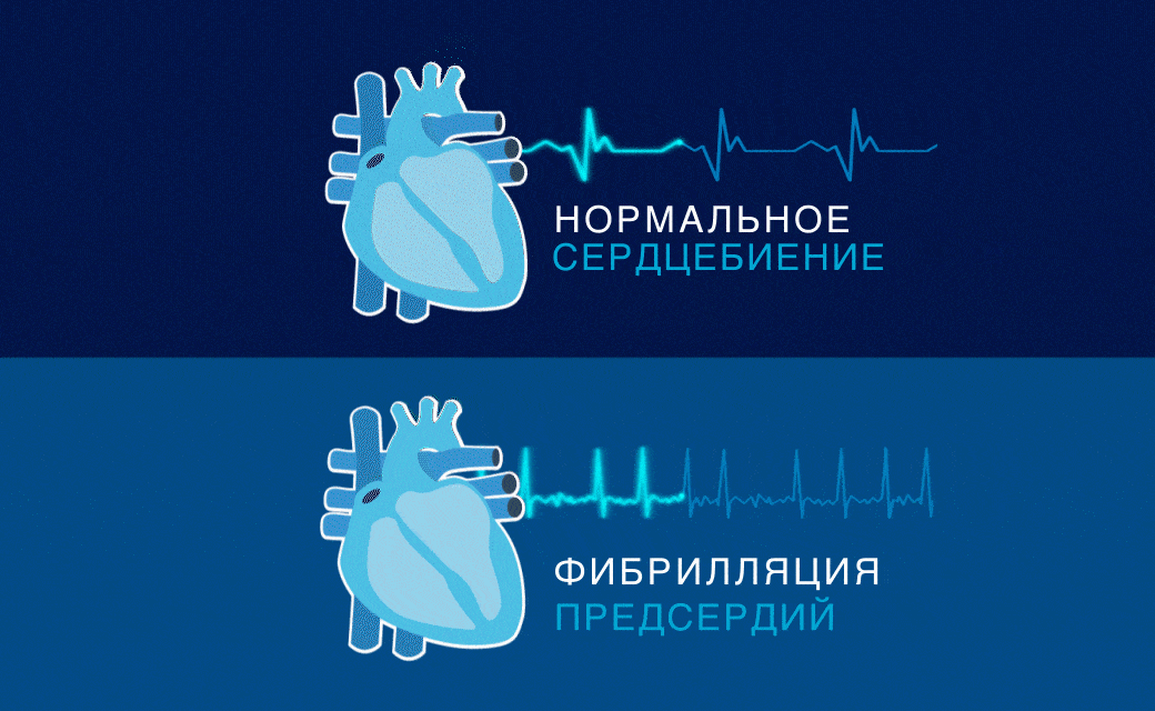 Источник фото: https://takecareofyourheart.ru