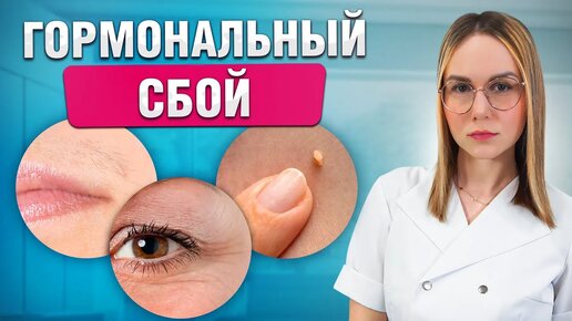 Первые симптомы проблем! Почему происходит гормональный сбой?