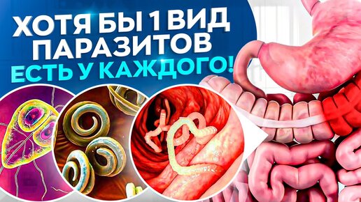 5 самых распространенных видов паразитов, которые живут в теле человека