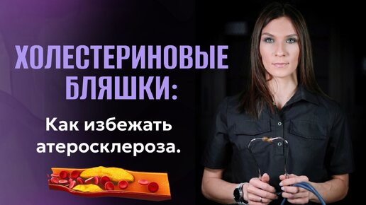 Холестериновые бляшки Как избежать атеросклероза Запись на консультацию: https://doctor-nefedova.ru/