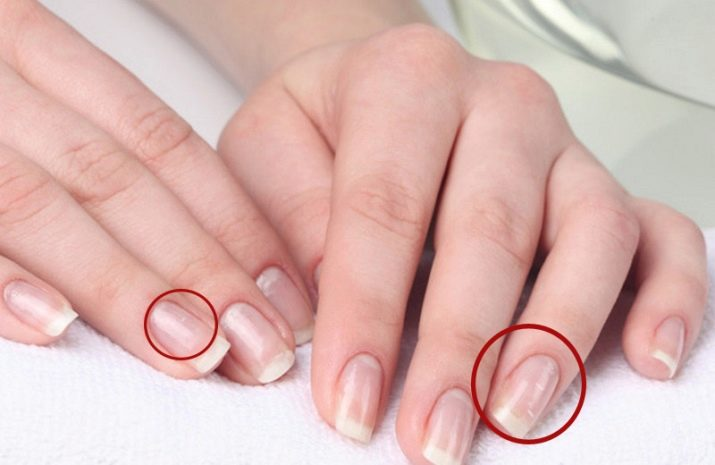 Розовый цвет ногтей. gerpespro.ru