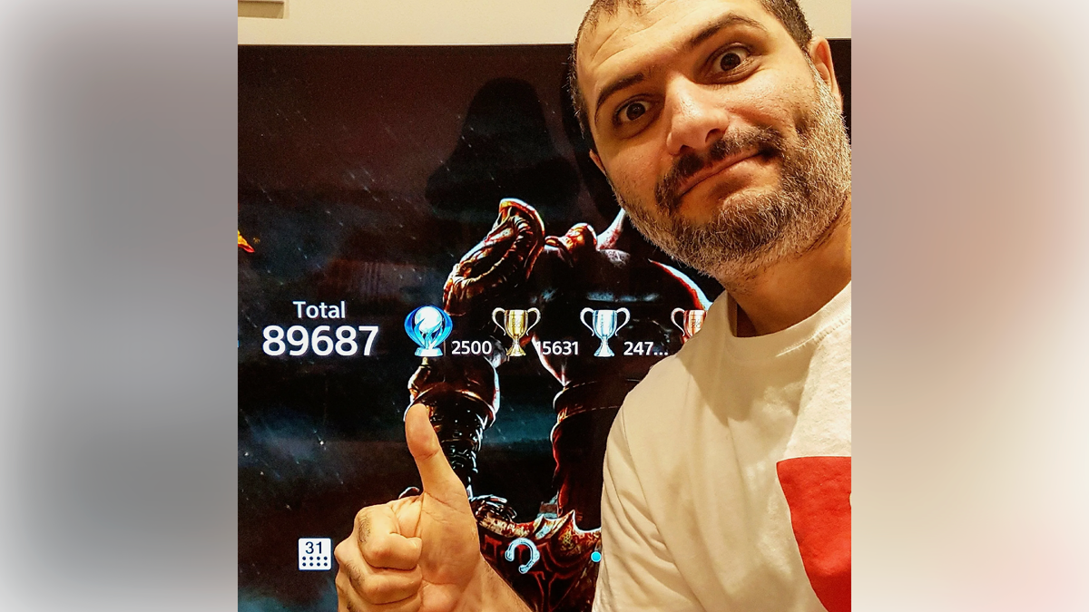 Что с глазами Карим? Глаукома?