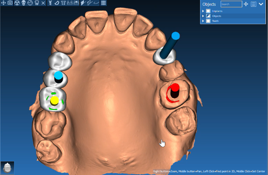 Коронки расставлены в планировщике