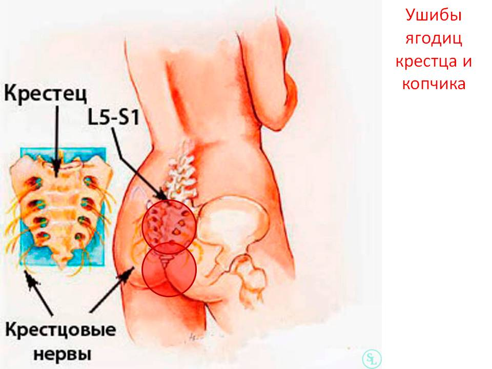 Крестцово-подвздошный сустав (или, проще говоря, крестец) - это место, где позвоночник прочно соединяется с тазом.-2