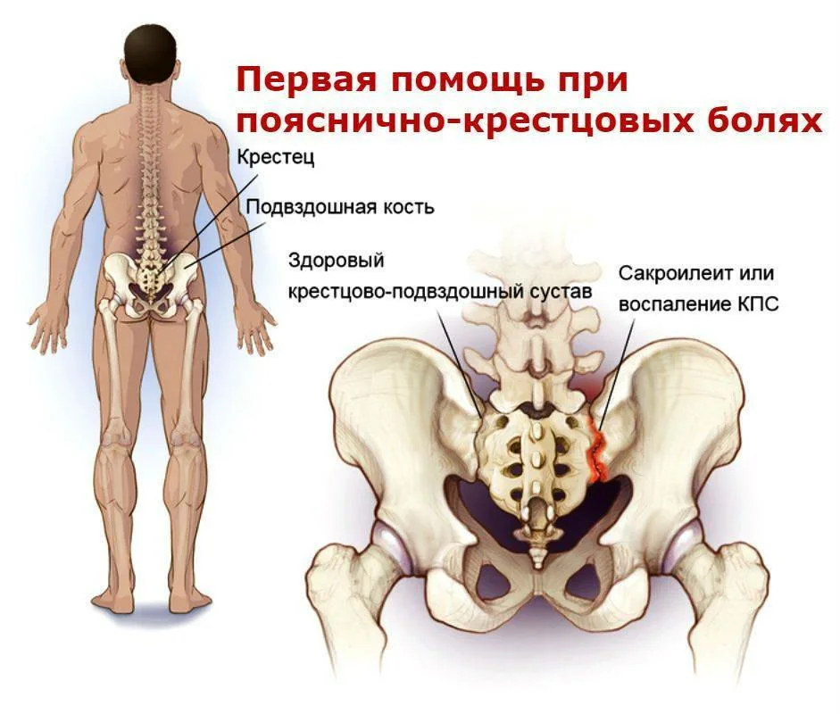 Крестец на ранних сроках