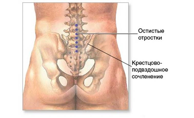 Пояснично-крестцовые боли