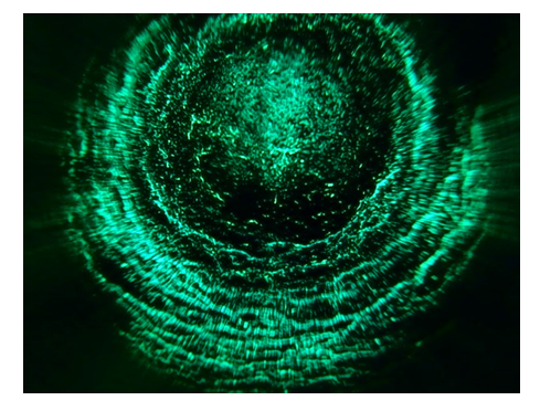 Клетка крови больного раком