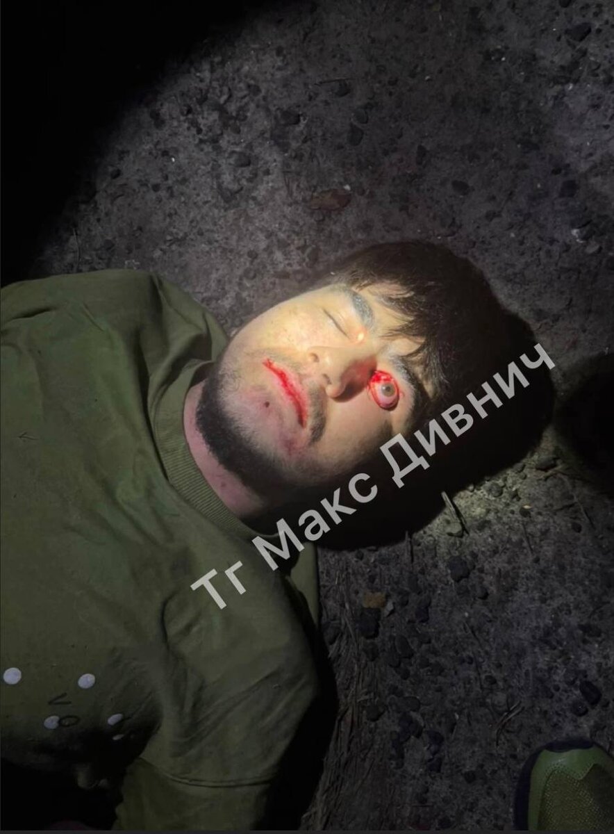 Подозреваемые