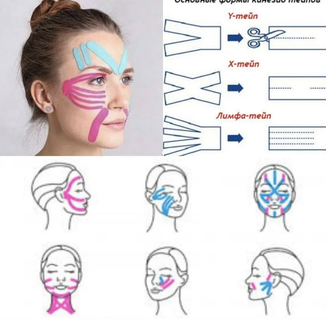 Тейп kinesiology tape оранж. Тейпирование что это такое. Тейпирование лифтинг тейп. Тейпирование что это такое. Кинезио тейп kinesiology kinesiology tape 5см серый.