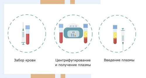 Плазмотерапия эндометрия