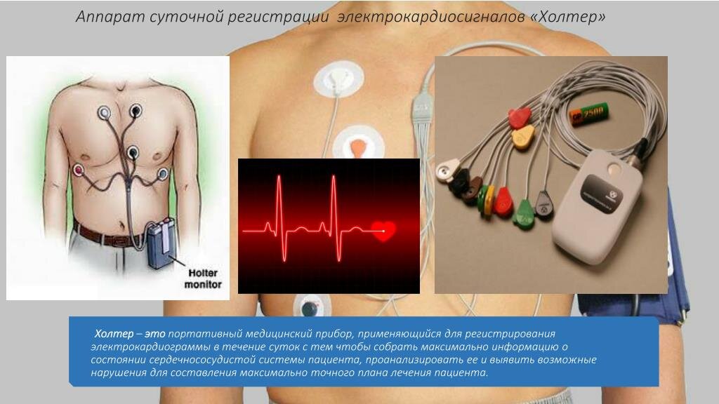 Как снять монитор Холтера самостоятельно