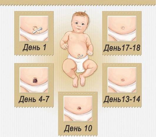 Заживление пупка у новорожденных: когда заживает, как выглядит, сроки и стадии