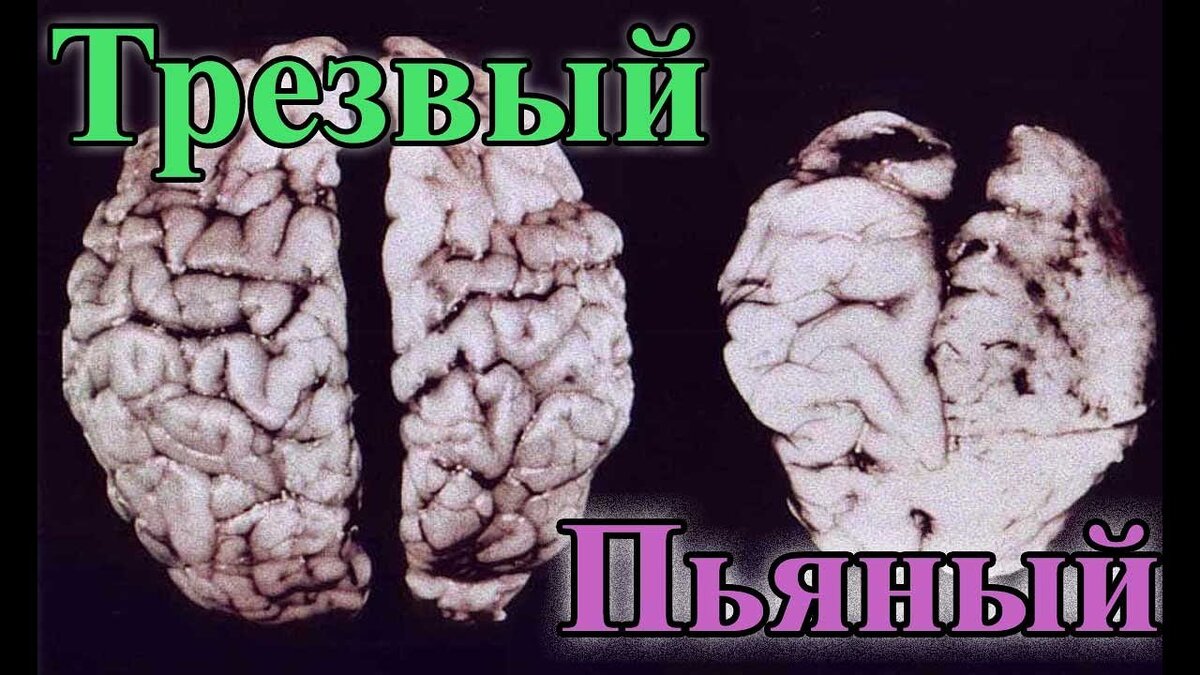 Алкоголь и зачатие у мужчин, как готовиться к зачатию ребенка будущему папе | Наркология Сана