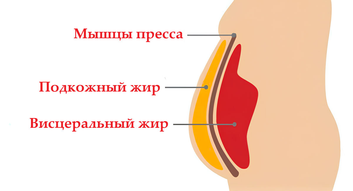 Почему заплываю жиром. Подкожный жир и висцеральный жир. Висцеральный жир в брюшной полости. Подкожный, висцеральный жир на животе.