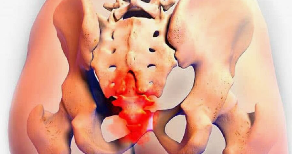 Почему возникает сильная боль в копчике – кокцигодиния: как помочь в устранении боли