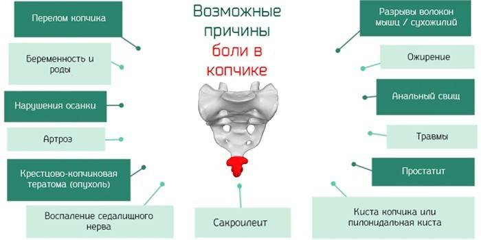 Киста копчика - лечение эпителиального копчикового хода без операции