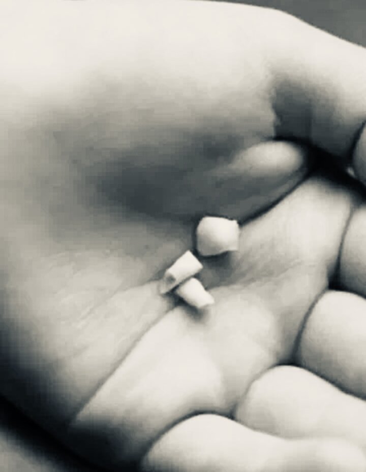 Как очень рано зубки вылезли, так очень рано и потеряла их Манька