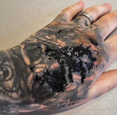 Как удалить тату дома с помощью марганцовки?