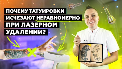 Descargar video: Почему татуировки исчезают неравномерно при лазерном удалении?