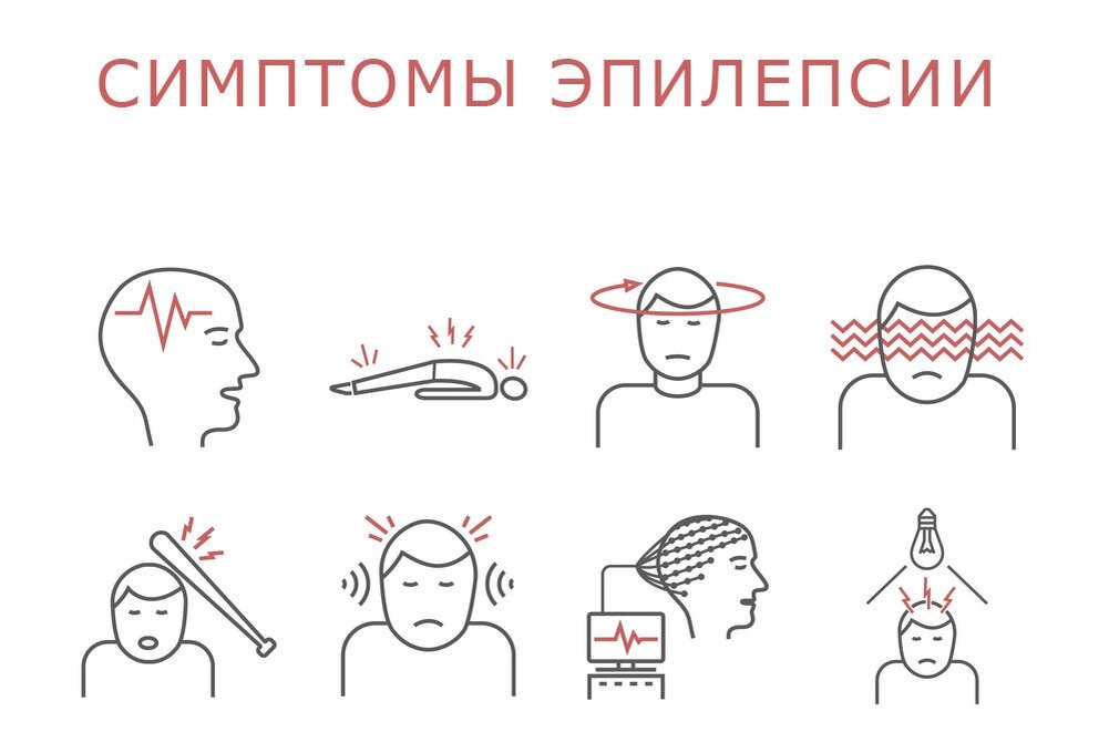 Эпилепсия симптомы и последствия. Признаки проявления эпилепсии. Характерные симптомы эпилептического припадка. Эпилепсия симптомы и последствия. Потеря сознания с судорогами.