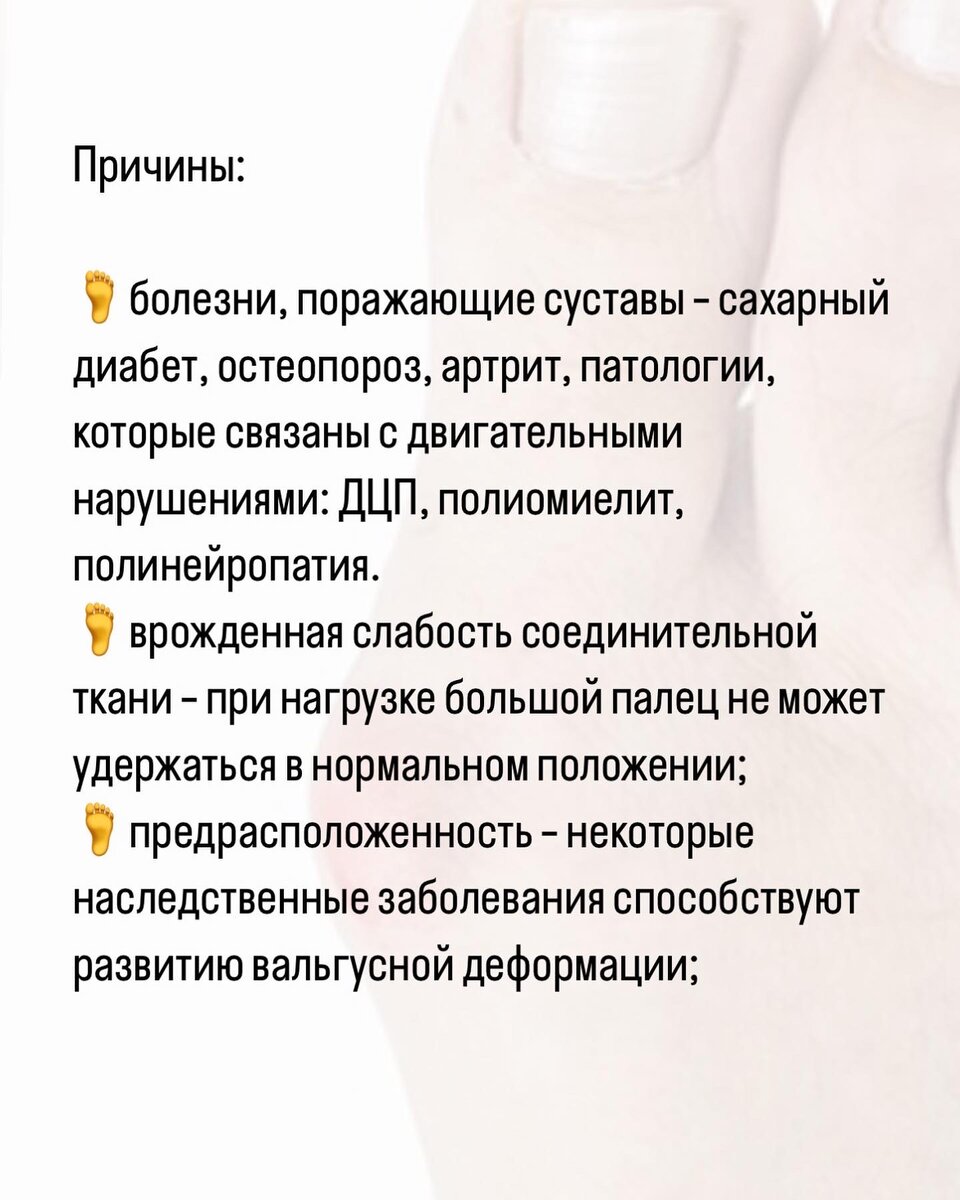 Что делать с косточкой на большом пальце? | Онлайн пилатес. Ирина Давыдова  | Дзен