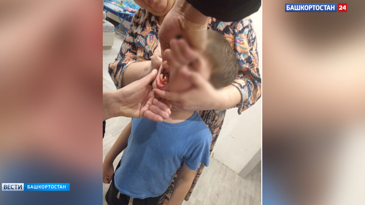    В Башкирии семилетний мальчик надел деталь конструктора на зуб: потребовалась помощь спасателей