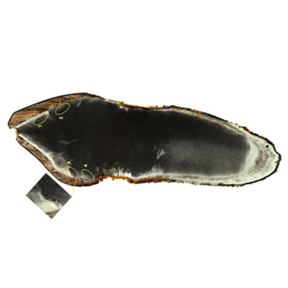 Правый постоянный клык верхней челюсти женщины из Коуч-Лейн, демонстрирующий примерно ежегодные эпизоды межглобулярного дентина.