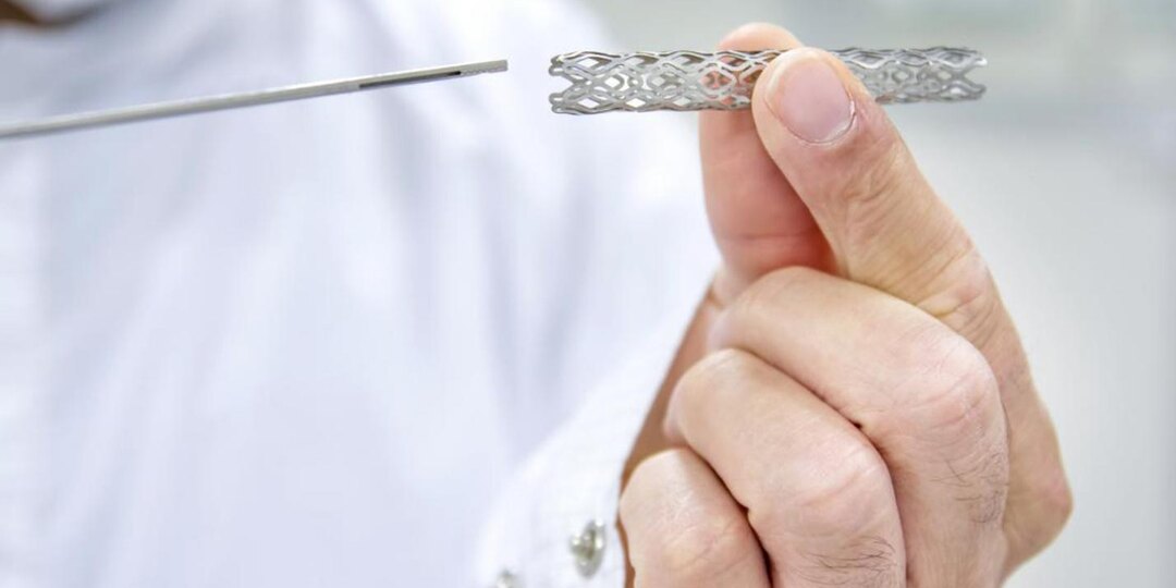 Стентирование — главное, что нужно знать