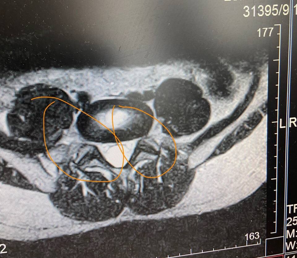Этот перекос нужно как то выровнять