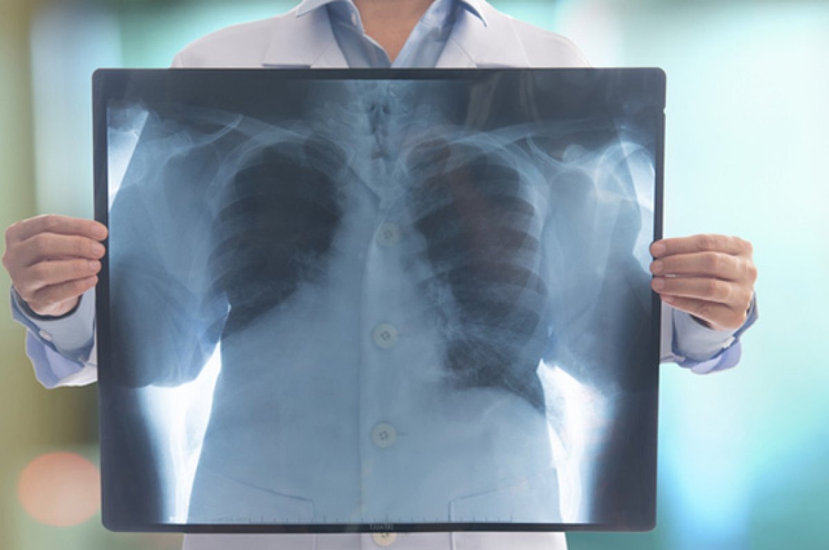    Научились разить заразу.