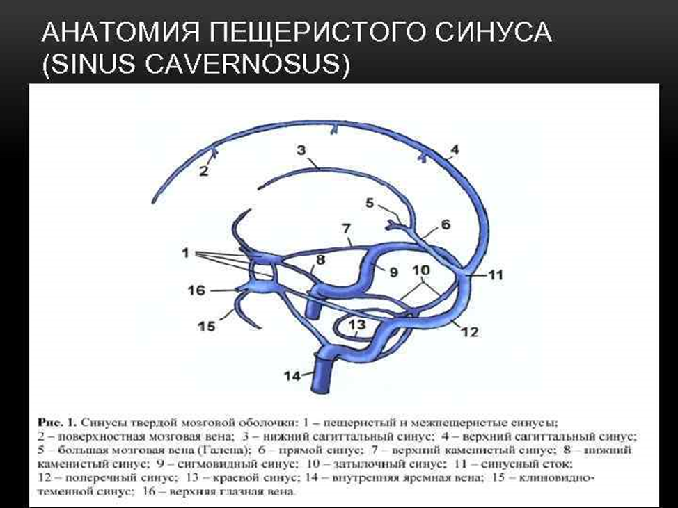 Латеральная стенка пещеристого синуса