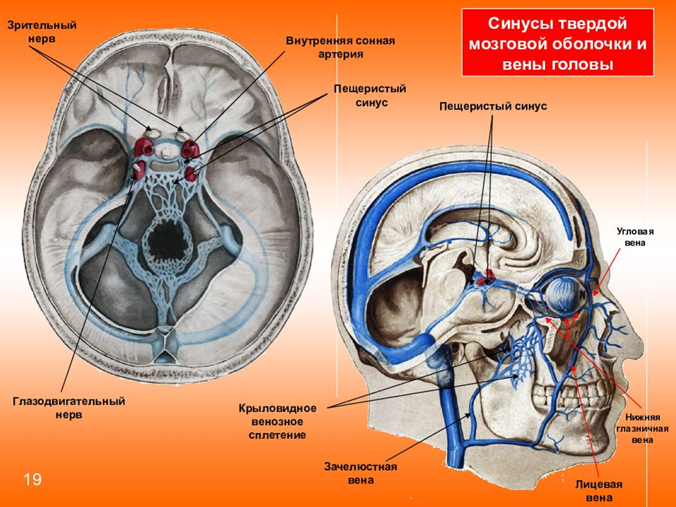 Синусы фото. Пещеристый синус фронтальный срез. Анатомия кавернозного синуса головного мозга. Вены головного мозга синусы твердой мозговой оболочки. Пещеристый синус и внутренняя Сонная артерия.