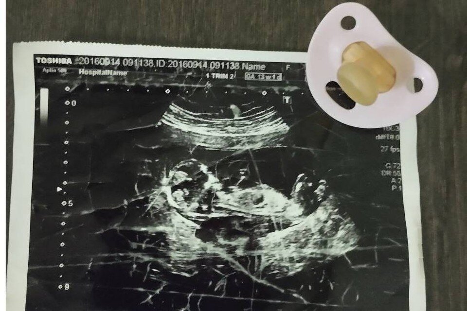    Светлана и Артем с нетерпением ждали рождения сына. Мальчик должен был родиться в марте 2017 года. Фото: личный архив Корниковых.