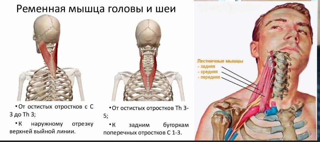 Сколиоз шеи: как исправить искривление шейного отдела позвоночника