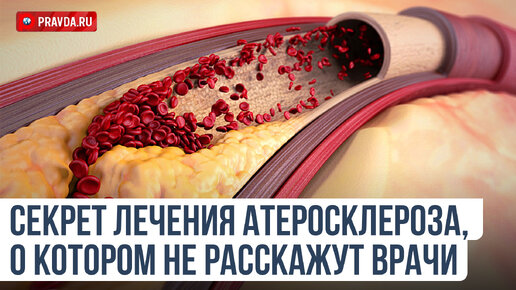 Самый вредный продукт для сердца. Что забивает наши сосуды и нас убивает?