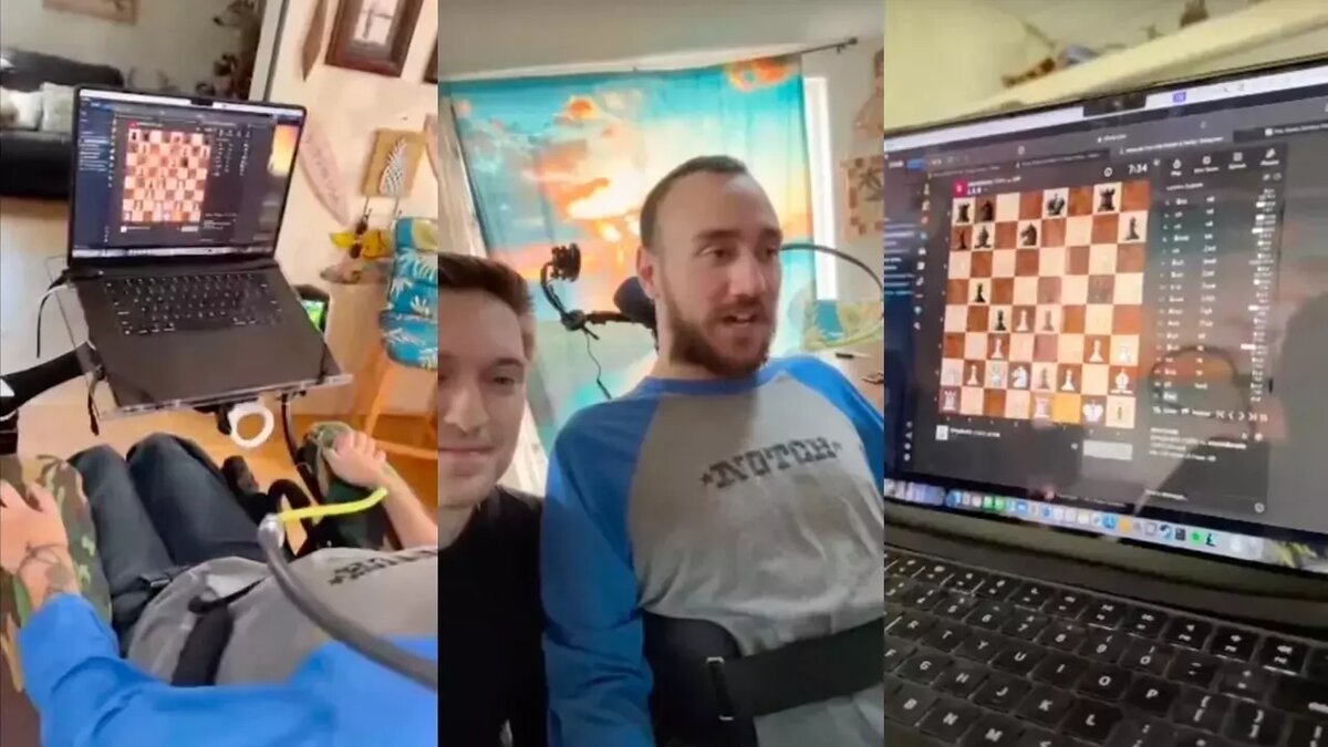     Первый человек, которому вживили имплант в головной мозг, управляет курсором силой мысли и играет в электронные игры.