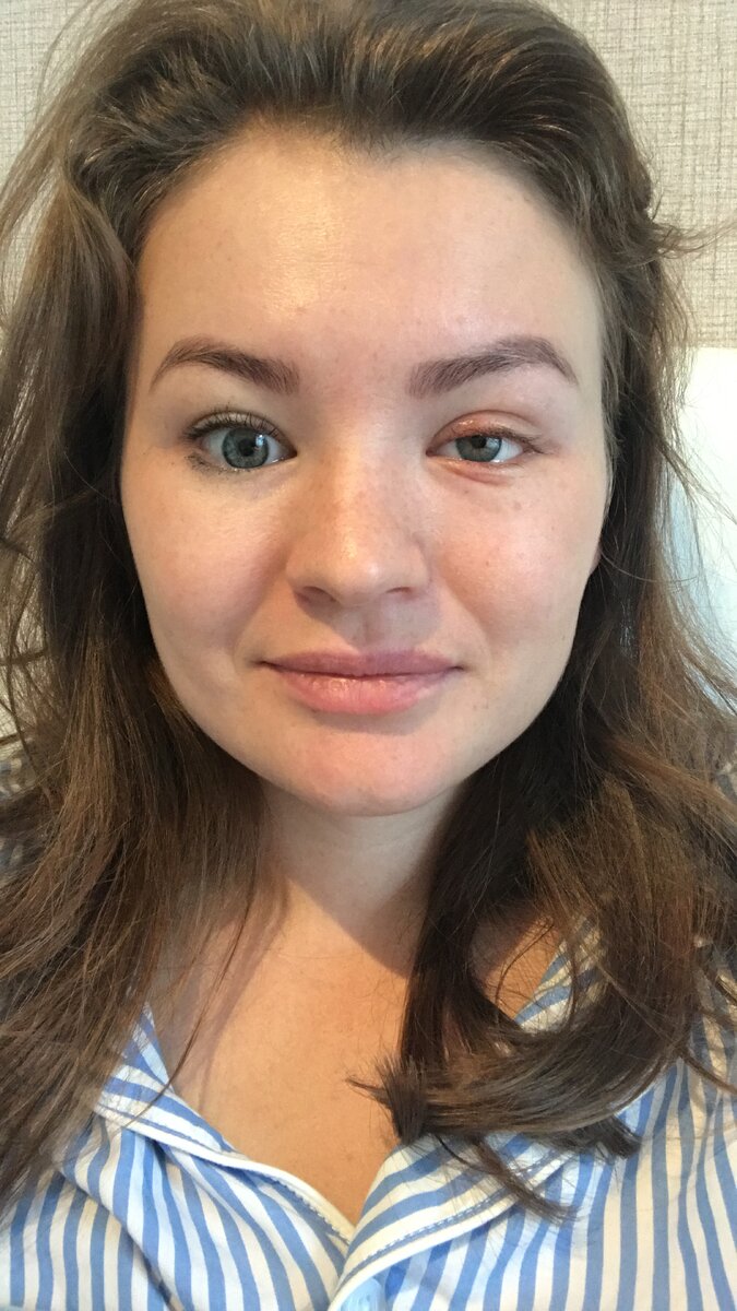 День, когда сняли швы