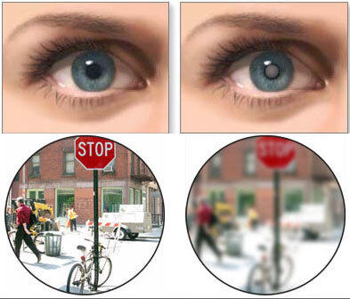 Как видит мир человек с прозрачным хрусталиком и катарактой