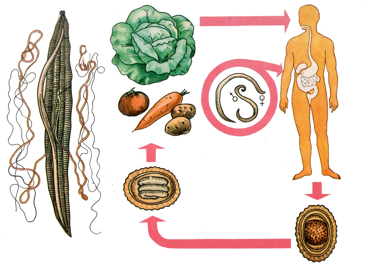 Аскаридоз: признаки паразитов в организме – на что обращать внимание и как  избавиться? | О здоровье: с медицинского на русский | Дзен